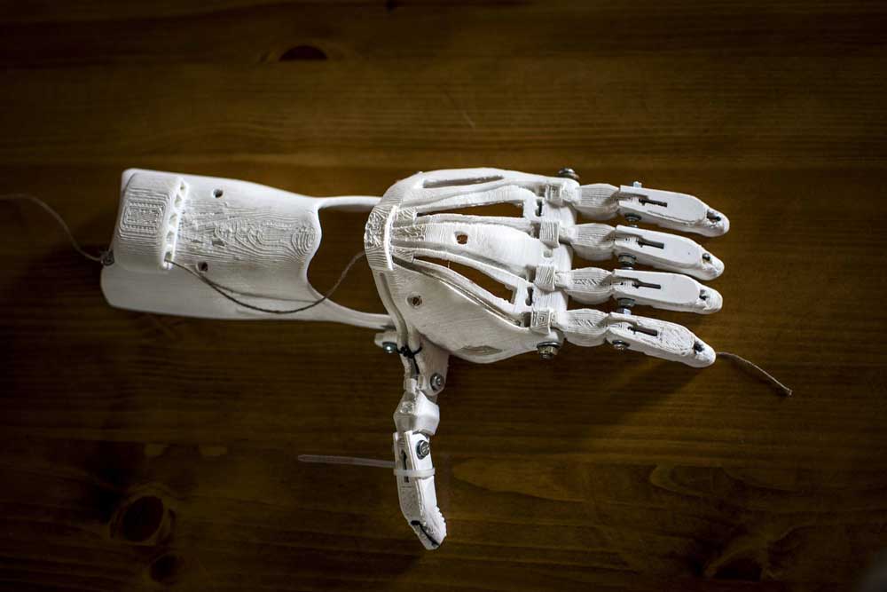 A 3D printed prosthetic hand